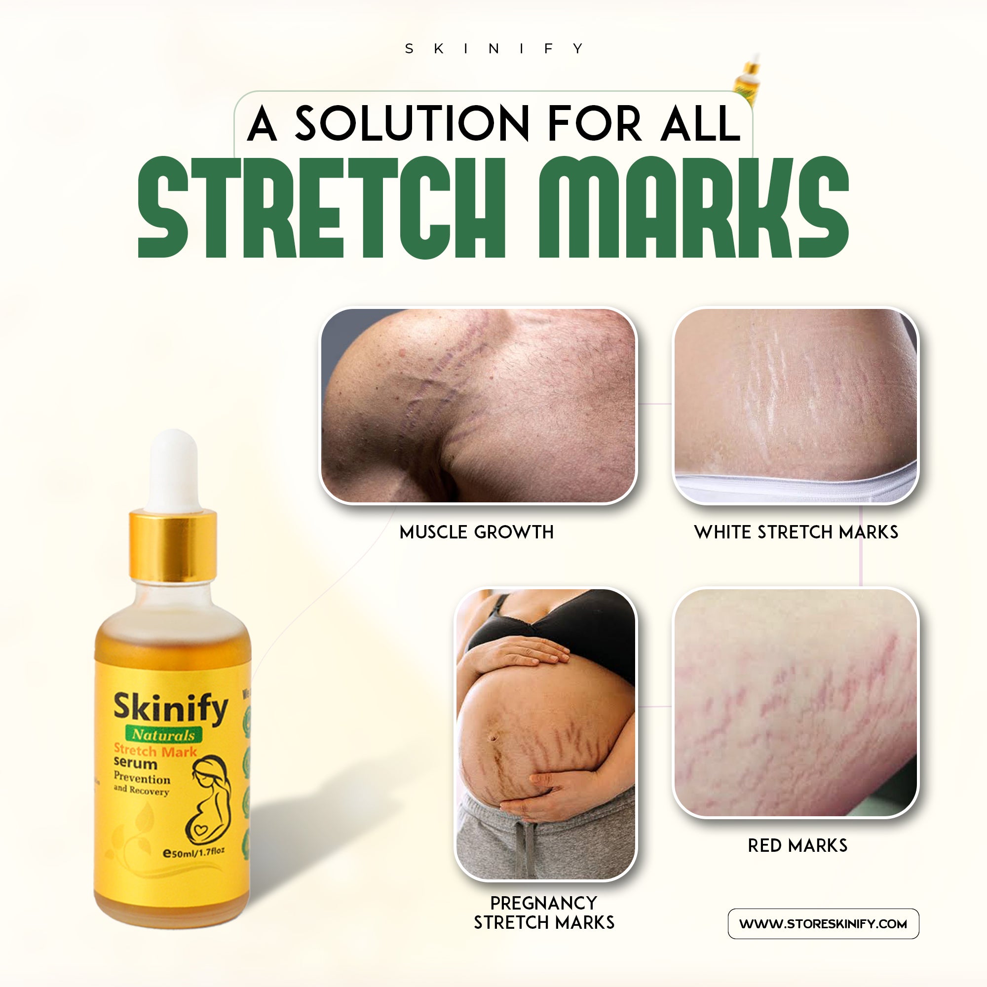 Stretch Marks Removal Maternity Skin Body Repair Serum By SKINIFY